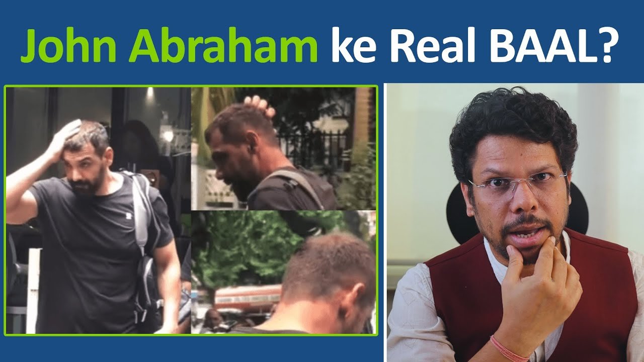 बागेश्वर बाबा धीरेंद्र शास्त्री के बाद अब जॉन अब्राहम की बालों की समस्या पर डॉ. अशोक सिन्हा का बड़ा खुलासा! 1 Dr. Ashok Sinha